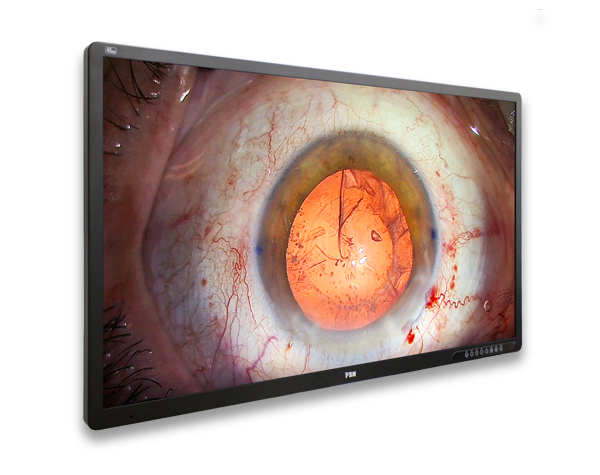 Màn hình phẫu thuật nội soi 3D 4K FSN FM-A5505DGC 55 inch