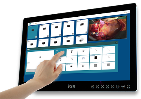 Màn hình phẫu thuật nội soi FSN FS-E2102DT